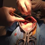 Chirurgie de hernie diaphragmatique d'un chat réalisée par le Dr GEIB