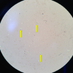 Cristaux de struvite observés au microscope